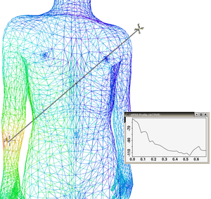 
Simulation of a transmitter implanted in the right forearm.
The user has interactively drawn a line segment in the 3D virtual scene.
A graph showing signal strength along that line is displayed.
